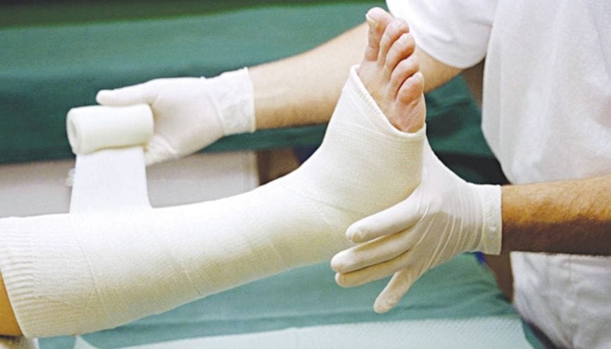 Thạch cao thường tồn tại dưới nhiều dạng khác nhau trong đời sống