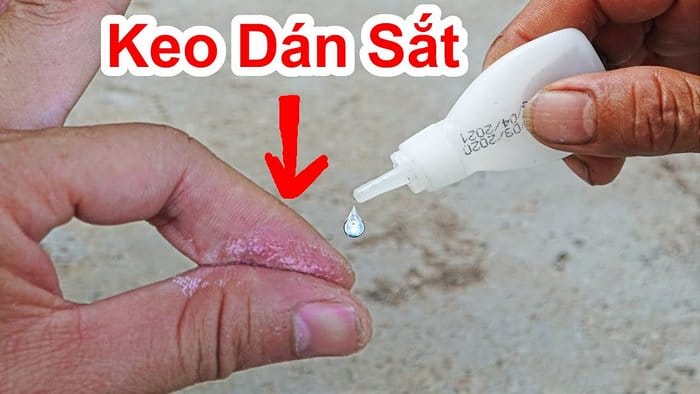 Keo dán sắt dính tay nếu không xử lý đúng có thể khiến da trầy xước hoặc rách biểu bì