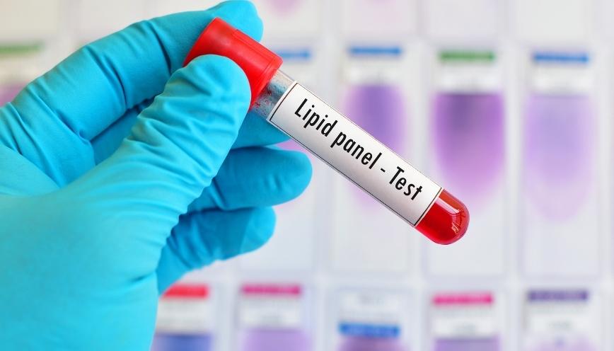 Lipid là gì? Phân loại, vai trò và nguồn bổ sung đúng